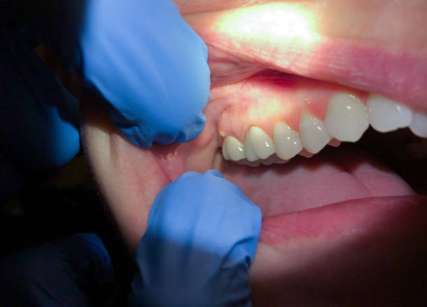 Best Emergency TMJ Treatment in Travelers Rest, SC
