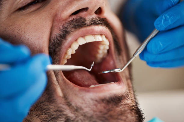 Best Emergency Dental Care for Broken or Chipped Teeth in Travelers Rest, SC
