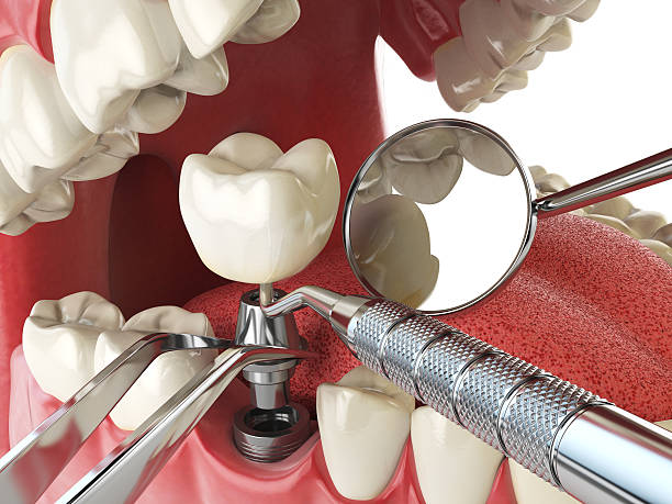 Best Emergency Denture Repair in Travelers Rest, SC